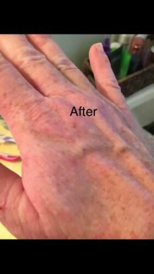 No More Eczema Organic Handmade Soap – Gentle & Soothing